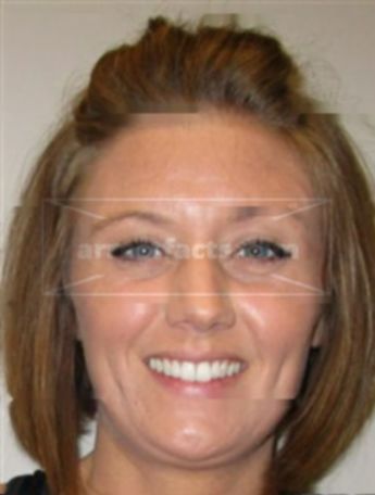 Melissa Renee Strode