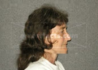 Vickie A Carstensen