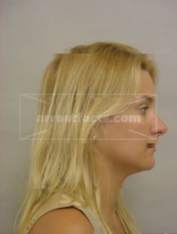 Meesha Faye Hoffman
