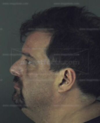 Richard J Burchill