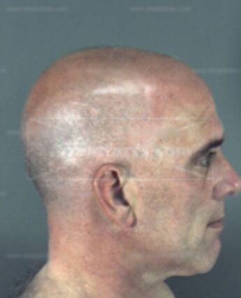 Joseph Daniel Zoll
