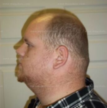 Travis L Harris