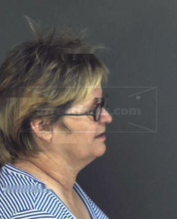 Cynthia Lynn Nickerson
