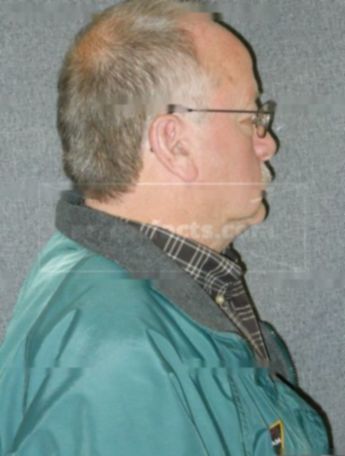 Robert H Benson
