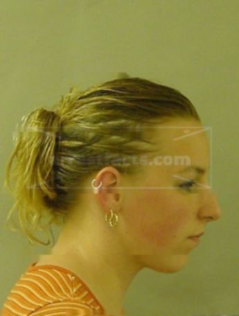 Claire M Burich