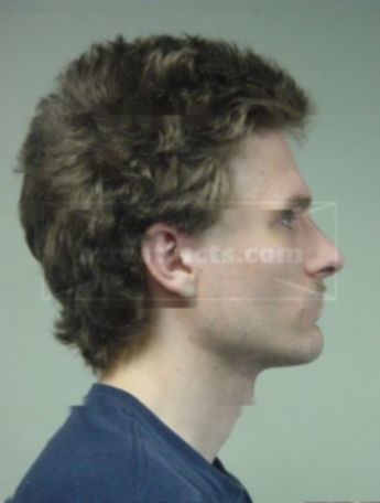 Matthew R Streekstra