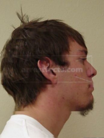 Aaron J Ebensperger