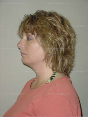 Sandra L Meinen