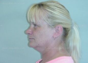 Patricia J Knudson