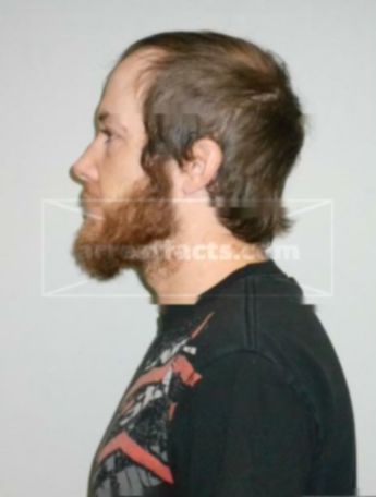 Joshua R Huempfner
