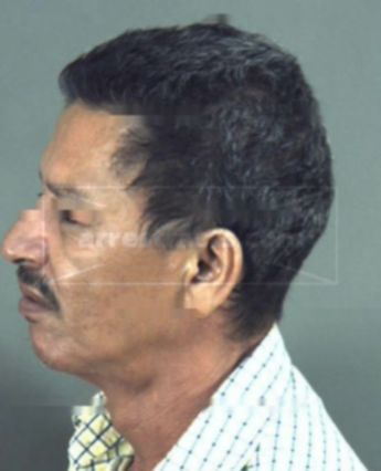 Dimas Arauz