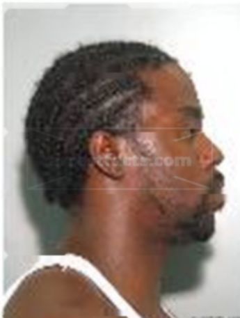 Dedrick Battle