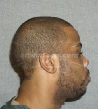 Jerrell J Griffin