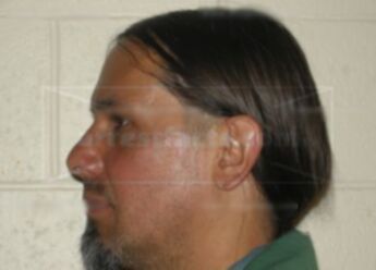 Todd M Norton