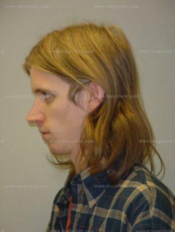 Zachary H Chisholm