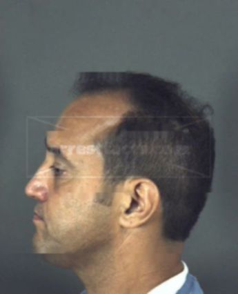 Anthony Joe Milo