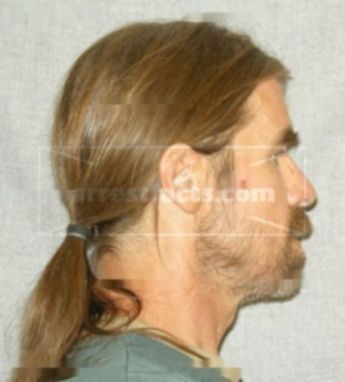 Jesse A Goetz