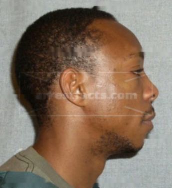 Alfonso Taylor