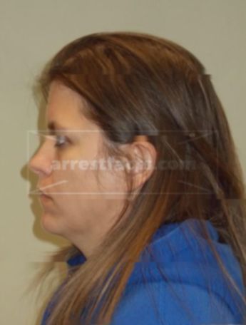 Regina L Guenther