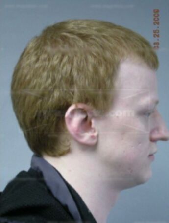 Andrew T Winch
