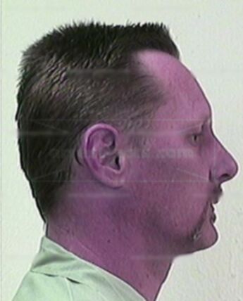 John W Adkins
