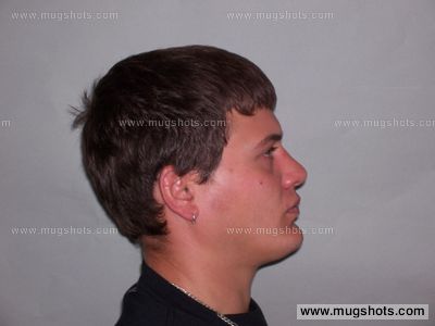 Bradley G Dhein