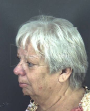 Linda Lee Allen