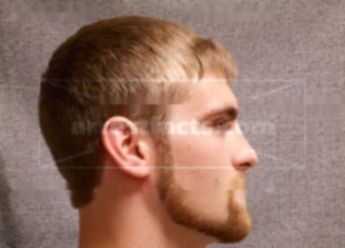Brandon M Doescher