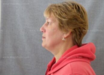 Susan Schultz