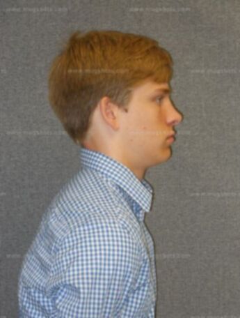 Logan G Schwebs