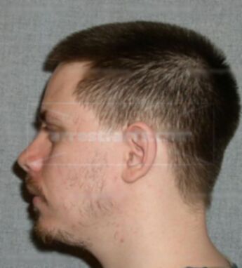 Michael J Harman-Derosier
