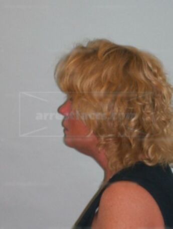 Sandra L Ehrfeld