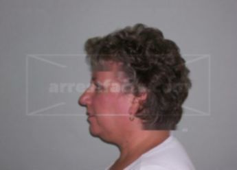 Cheri D Hoffman