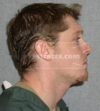Jared R Chase