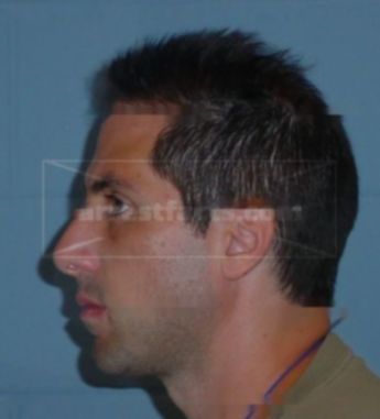 James Kuralle