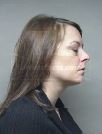 Rebecca M Nitschke