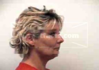 Cynthia M Huffman