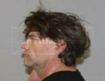 Robinson Lee Ostler