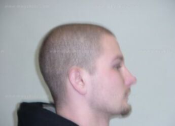 Matthew J Gagnon
