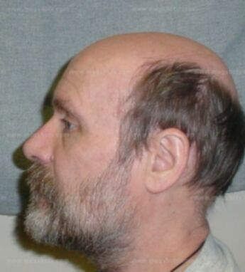 James D Lammers