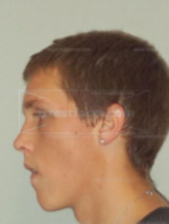 Brandon M Meyer