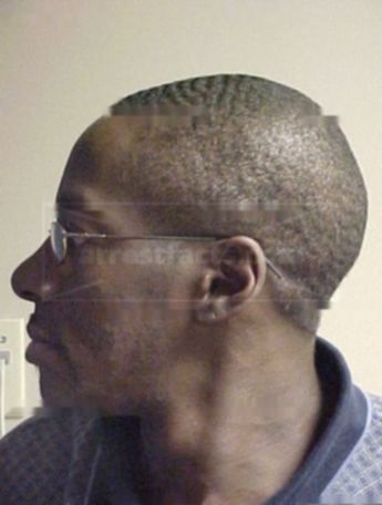 Darren L Coleman