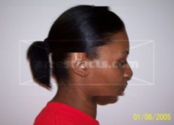 Ondraya M Murrell