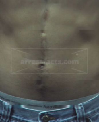 Juan Manuel Garcia