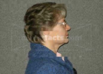 Roseanne G Kincheloe