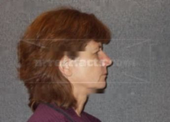 Susan L Buletti
