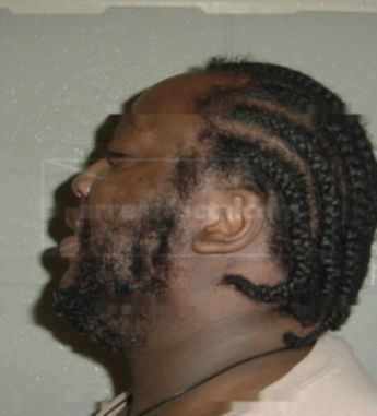 Alonzo Patterson