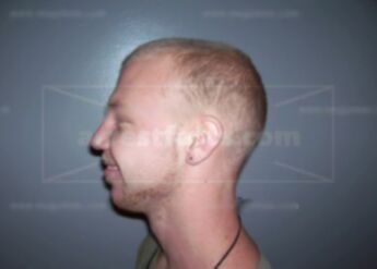 William Dake Jr.