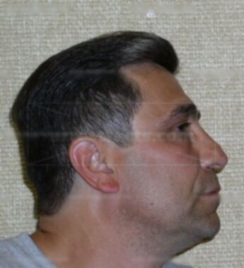Rocco Fasano