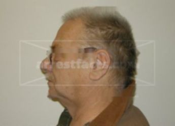 Ronald W Champeau